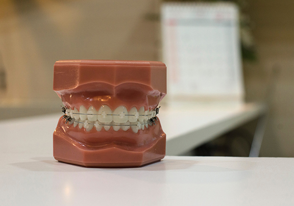 human jaw model with metal wired dental braces